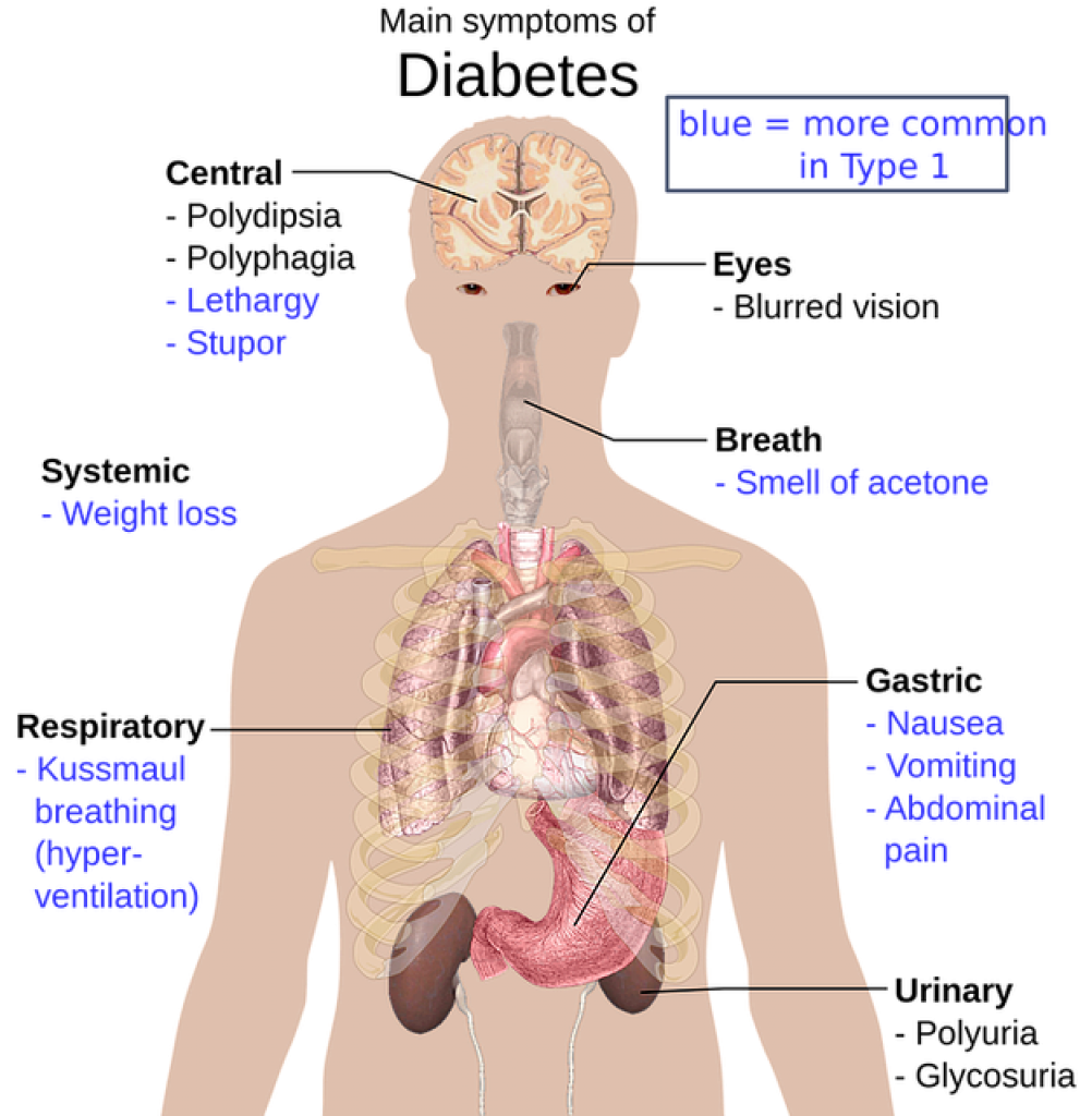 can-type-1-diabetes-turn-into-type-2