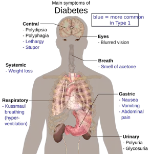 Can type 1 Diabetes Turn Into Type 2