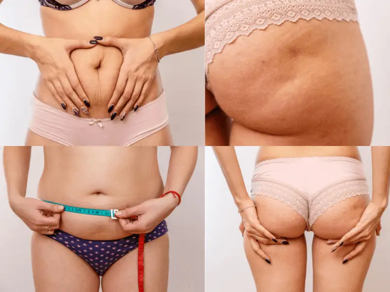 How to Get Rid of Pubic Fat