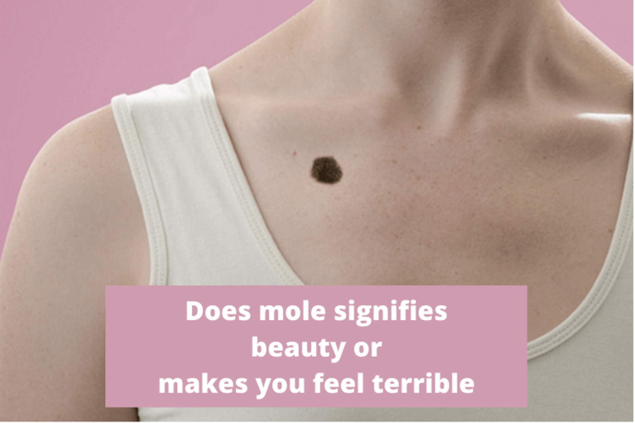 How to Remove Moles from the Private Part of the Body?