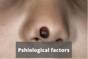 Moles Physiological Factor