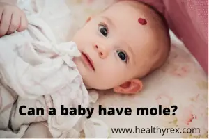 Can a baby have a mole
