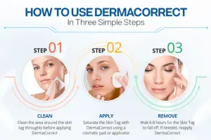 How To Use Derma Correct Skin Tag Remover