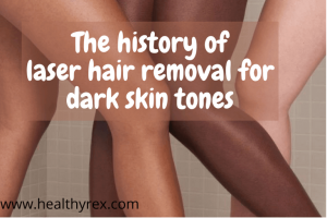 The History of Laser Hair Removal for Dark Skin Tones