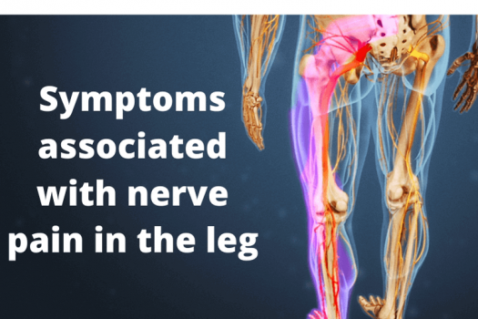 nerve-pain-in-the-leg-causes-symptoms-treatment-exercise