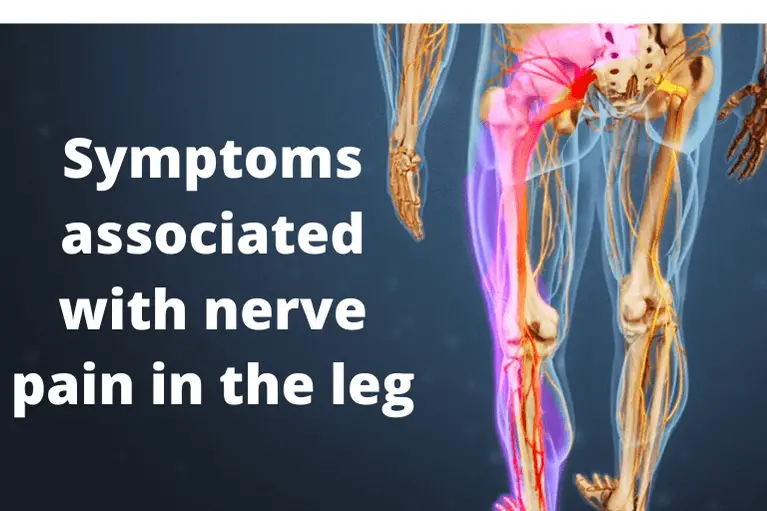 Nerve Pain In The Leg Causes Symptoms Treatment Exercise