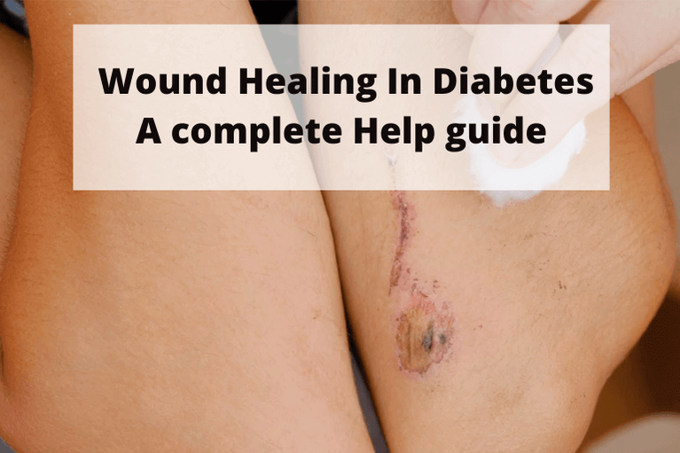Wound Healing In Diabetes