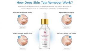 How Does Amarose Skin Tag Remover Work