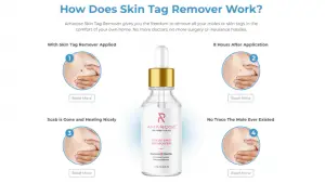 How Does Amarose Skin Tag Remover Work