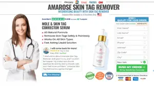 What is Amarose Skin Tag Remover?