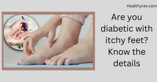 Are You Diabetic With Itchy Feet? Know the details