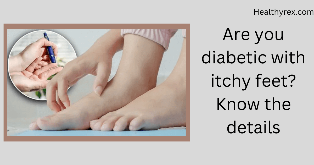 Are You Diabetic With Itchy Feet?