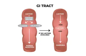 Symptoms of Lactose Intolerance in Adults