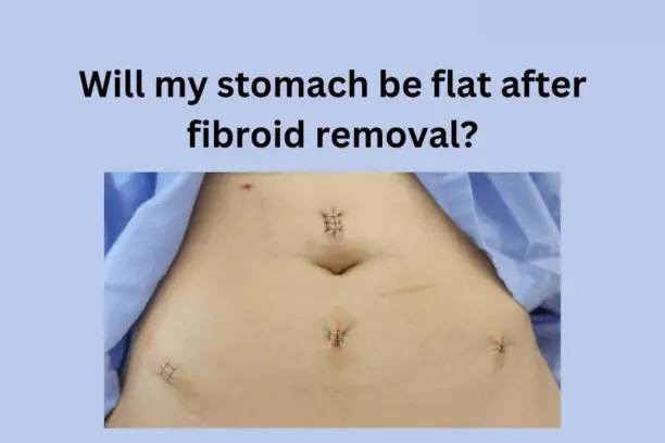 Will my stomach be flat after fibroid removal?