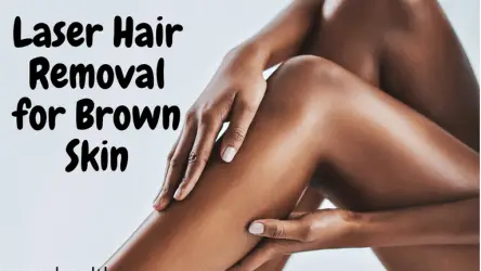 Laser Hair Removal For Dark Skin – Everything You Need To Know