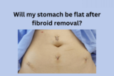 Will my stomach be flat after fibroid removal?